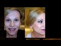 Sarah's Before & After