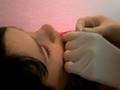 Mon percage de Labret
