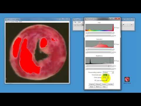how to use imagej to measure length