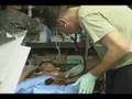 Surgical Team works against the clock