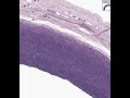 Shotgun Histology Aorta Elastic Stain Shotgun Histology Aorta Elastic Stain