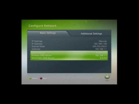 how to adjust dhcp settings for xbox