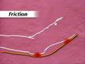 Caring for Pressure Ulcers pt 1of 4