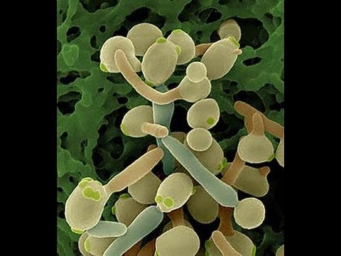 how to cure candida uk