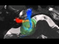 Vestibular Schwannomas and Cranial Nerves Modeling in 3D in vivo with use of DTI
