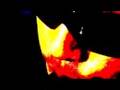 Mental Breakdown Music Video