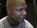 NBA Star - Alopecia Areata