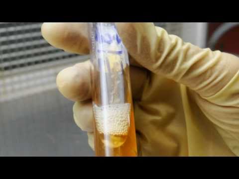 how to perform tsi test