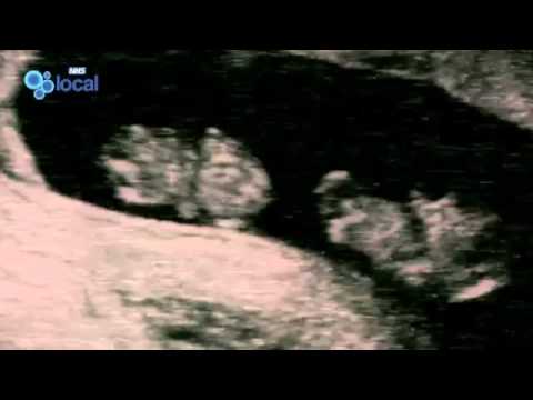 See video