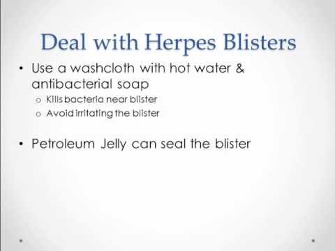 how to treat herpes with dmso