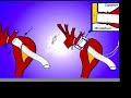 Expandable prosthesis for sutureless aortic anast. in 2 min Expandable prosthesis for sutureless aortic anast. in 2 min