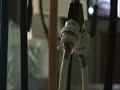 Robotic-Assisted Prostate Surgery