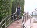 Chinese LAK man on prosthetics