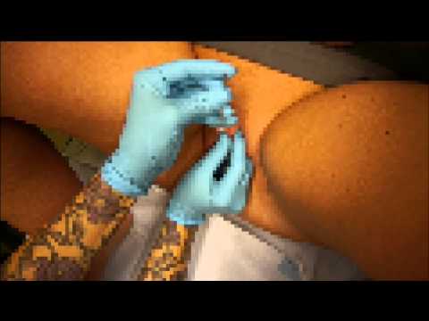 how to take care of a vch