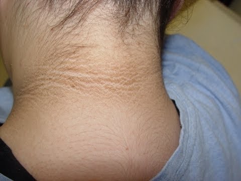 how to whiten back of neck