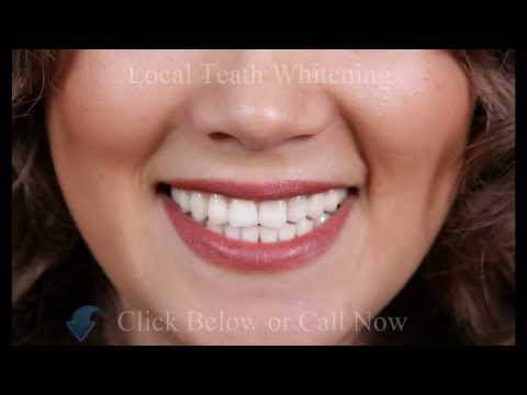 how to whiten teeth straight away