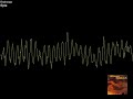 Eple - Röyksopp Eple - Röyksopp