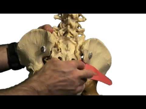 how to cure sciatic nerve pain