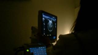 Ultra 36 semanas + 6 dias - Clínica Cors, Etti Mattos