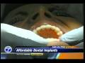 videos de 5-6pm CH-7 News on WXYZ, Friday, Dec 12th, 2008 - Dr. Kosinski