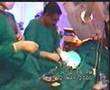 Angioplasty and Stenting