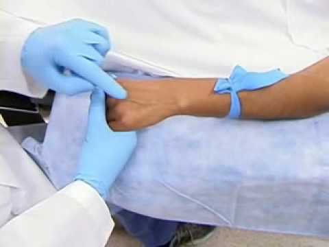 how to perform iv insertion
