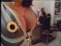 Breast-Inflation