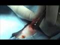 Ferret Spay
