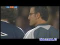 convulsions de Milan Baros OL - Lens convulsions de Milan Baros OL - Lens