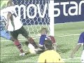 Jogador Paran� quebra o Bra�o