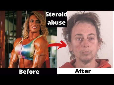 Bodybuilders Before \u0026 After Steroids |Top 5 Drastic Steroid ...