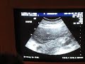 Liora and Sean's ultrasound