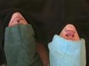 Yogurt Chins 2