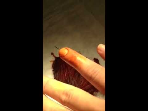 how to remove k wires