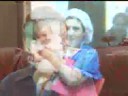 Operation Smile