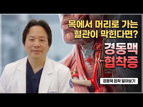 뇌졸중을 부르는 목 속의 시한폭탄, 경동맥 협착증