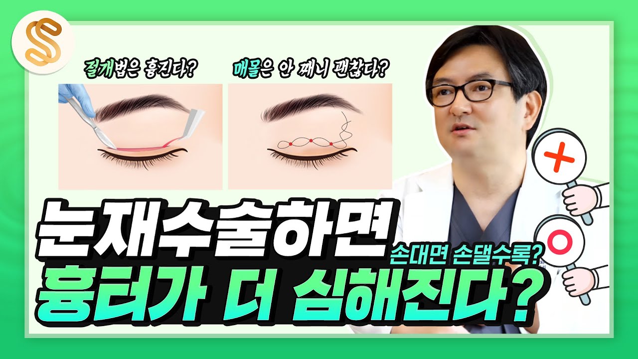 쌍꺼풀 수술 흉터가 고민이신가요? 쌍꺼풀 재수술 전 반드시 확인하세요!