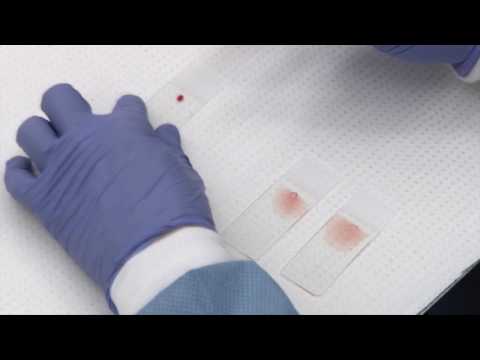 video-linktoworks-Making and staining blood smears