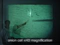 Onion cell magnification Onion cell magnification