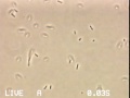 Enterobacter aer 1000x motile slow