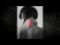 Chandler, AZ Neck Pain Relief - Dr. Jeff Cottingham