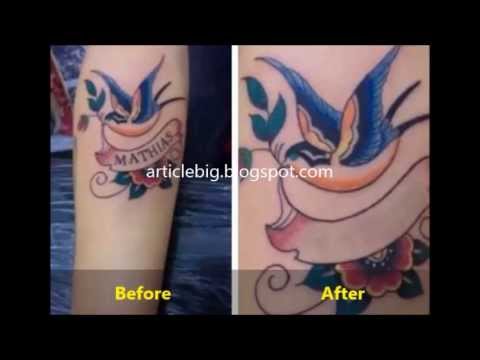 how to remove a tattoo with lemon juice