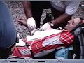 See Video