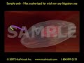 3D Medical Animation: Recombinant Adenoviral Genome