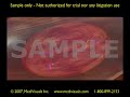 3D Medical Animation: Recombinant Adenoviral Genome