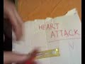 heART ATTACK 1x01 - Il Brufolo heART ATTACK 1x01 - Il Brufolo