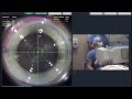 Dr. Scott Perkins Performs a LenSx Procedure-Barnet Dulaney Perkins Eye Center (AZ)