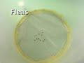 Best Yet - Story of a breakthrough to kill bed bugs and get rid of fleas