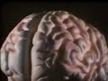 Schizophrenia