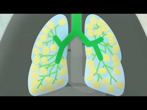 Image de prévisualisation YouTube